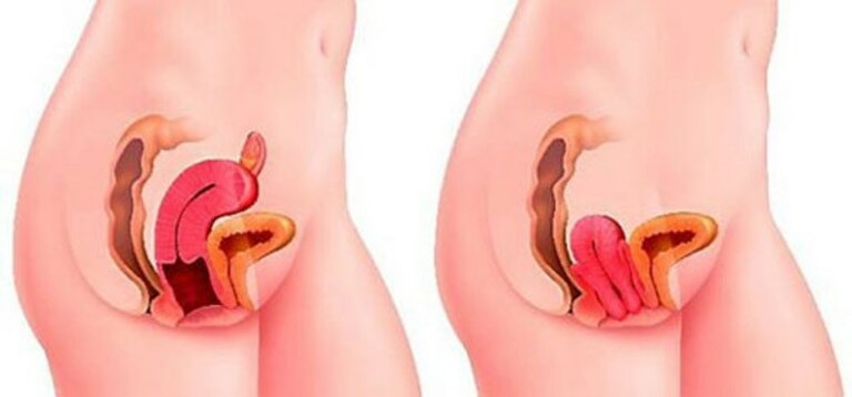 Co thắt âm đạo khi đạt cực khoái thường chỉ xuất hiện vài giây