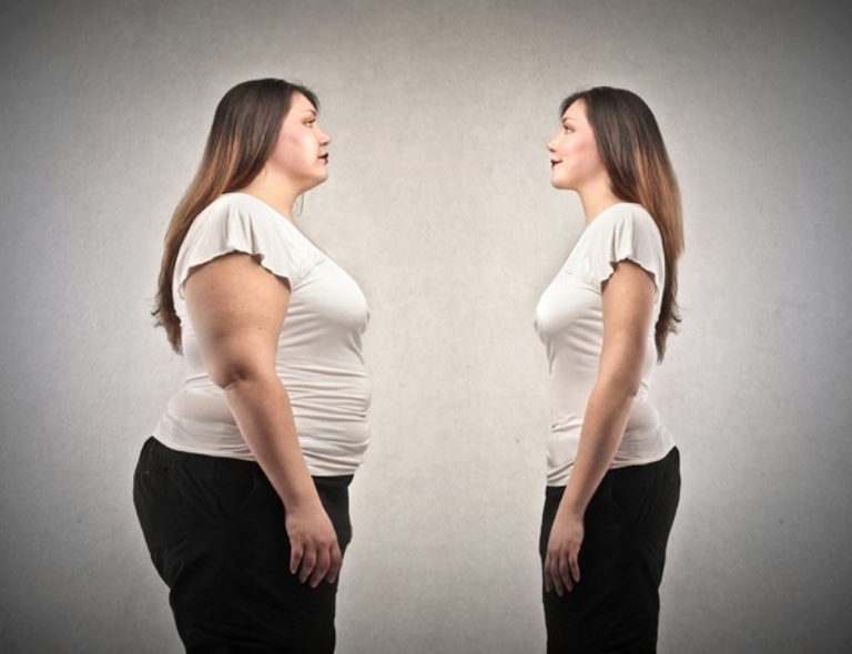 Những người béo phì có nguy cơ cao bị gai khớp gối so với những người có cân nặng bình thường