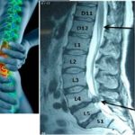 Các mô mềm được hiển thị rõ ràng, sắc nét khi chụp MRI