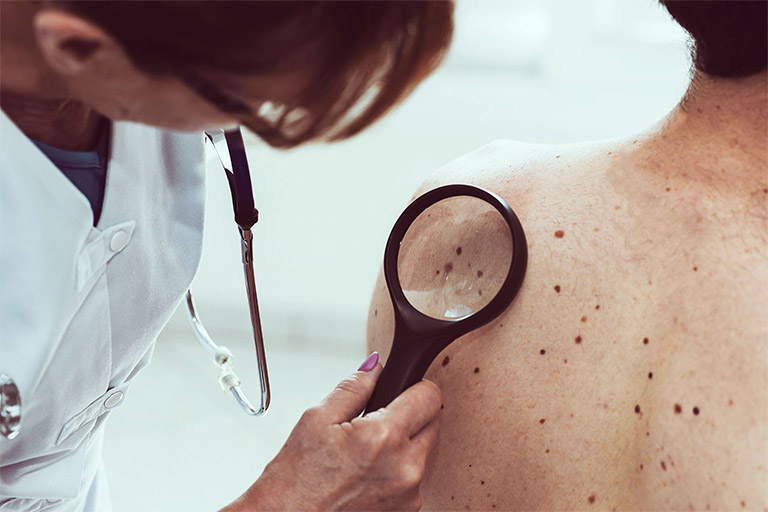 Tìm gặp bác sĩ để biết chính xác tình trạng nổi đỏ trên da và gây ngứa là biểu hiện của bệnh lý nào