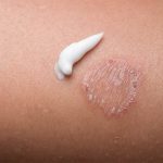 Thuốc trị bôi lác đồng tiền