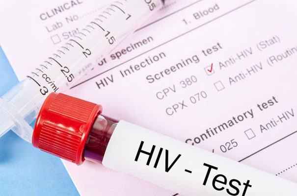 Nổi Mề Đay Do HIV: Cách Nhận Biết Để Tránh Biến Chứng Nguy Hiểm