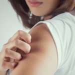 Sau khi quan hệ, nếu tình trạng mề đay diễn ra nghiêm trọng, không có dấu hiệu thuyên giảm, người bệnh cần đến gặp bác sĩ để điều trị.