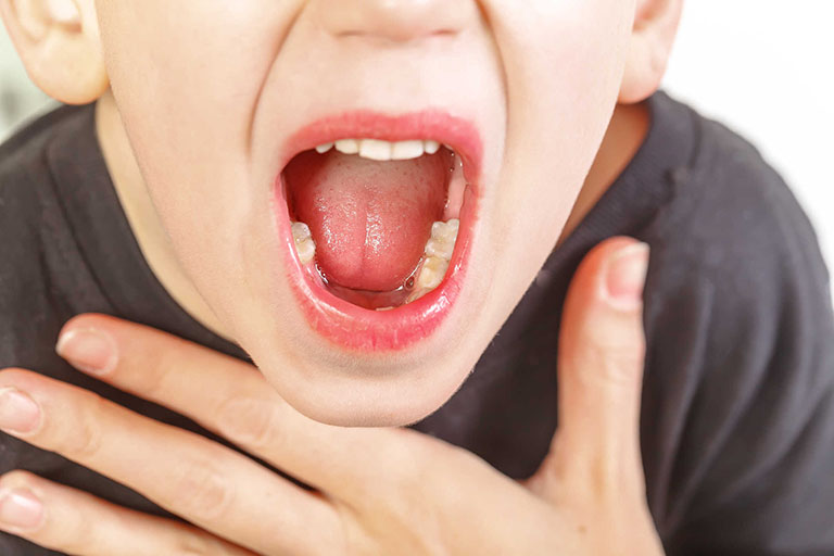 Đau họng, ngứa, thấy vướng víu trong cổ họng là những dấu hiệu bệnh thường gặp 