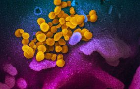 Virus Corona COVID-19