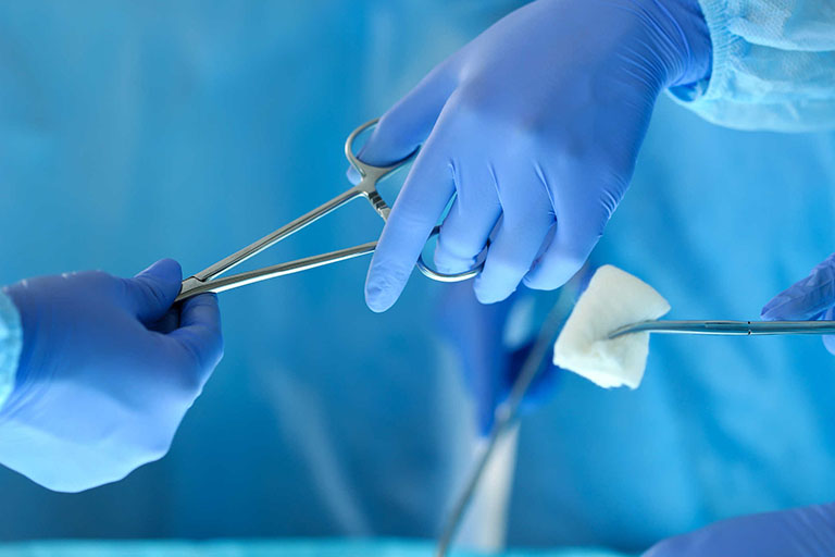 Tìm hiểu các phương pháp phẫu thuật trĩ 