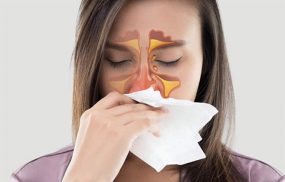 Viêm mũi xoang xuất tiết gây nhiều phiền toái cho người bệnh