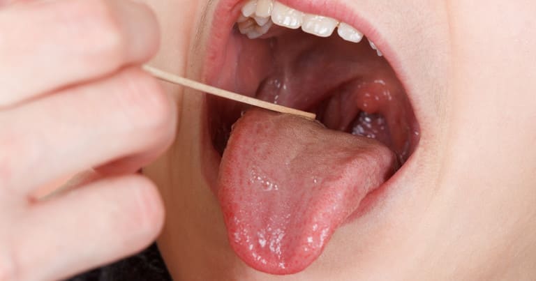 Triệu chứng đau họng đau tai là gì?