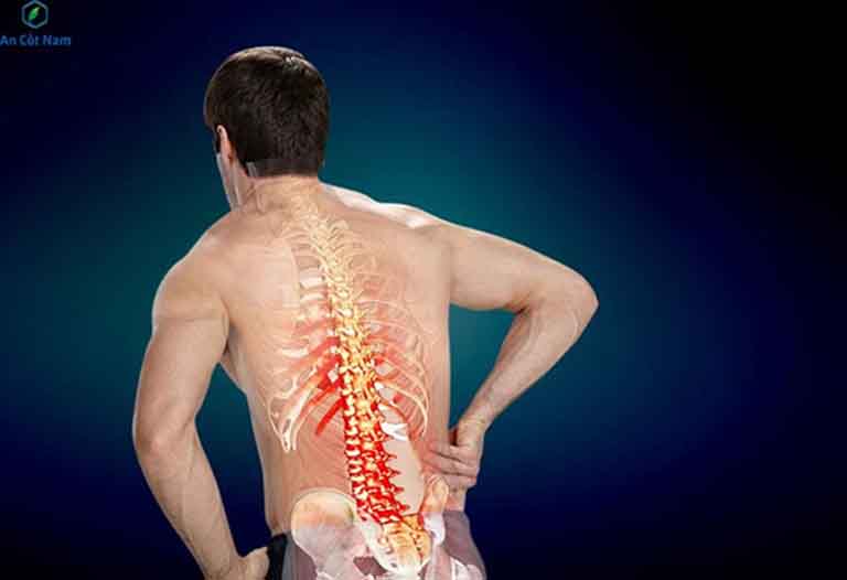 Trào ngược dạ dày gây đau lưng