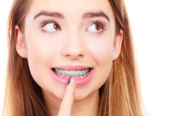TOP 10 địa chỉ niềng răng tốt nhất tại Hà Nội