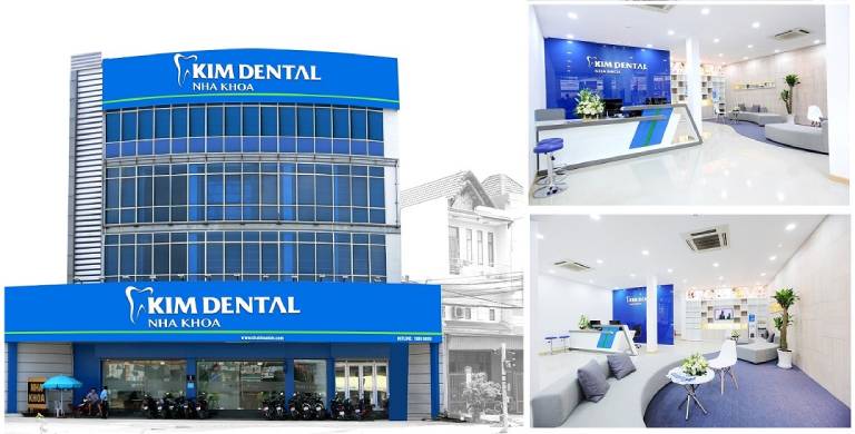 Nha khoa Kim cung cấp các thiết bị niềng răng chất lượng, đã được thông qua về tính an toàn và sức khỏe của răng miệng