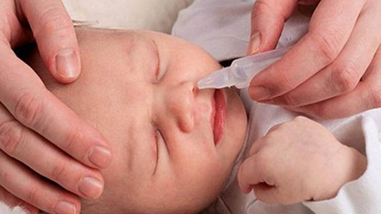 Điều trị viêm mũi dị ứng ở trẻ sơ sinh tại nhà