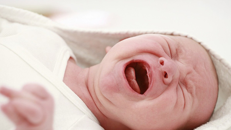 Dấu hiệu nhận biết trẻ sơ sinh bị viêm amidan