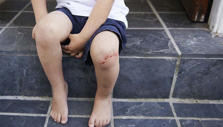 Đau khớp gối ở trẻ em cảnh báo bệnh gì