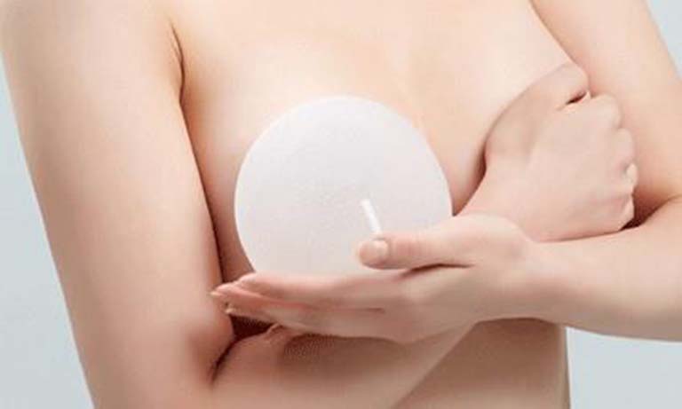 Nâng ngực nội soi là gì?
