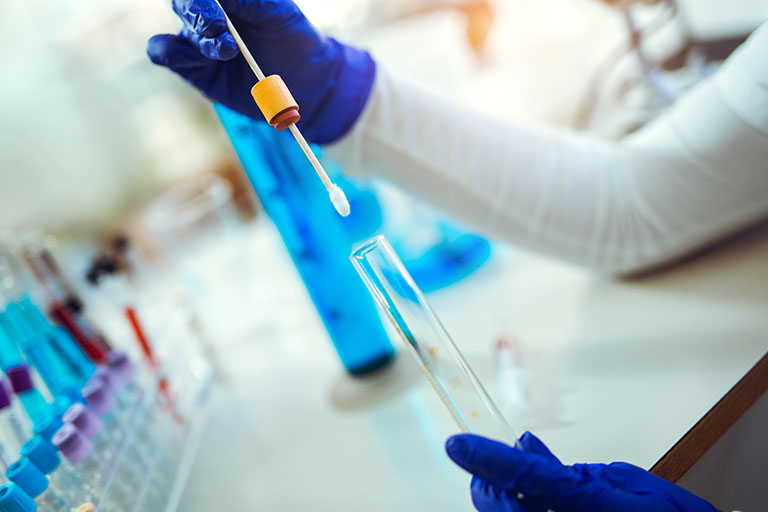Xét nghiệm ADN huyết thống cần những gì