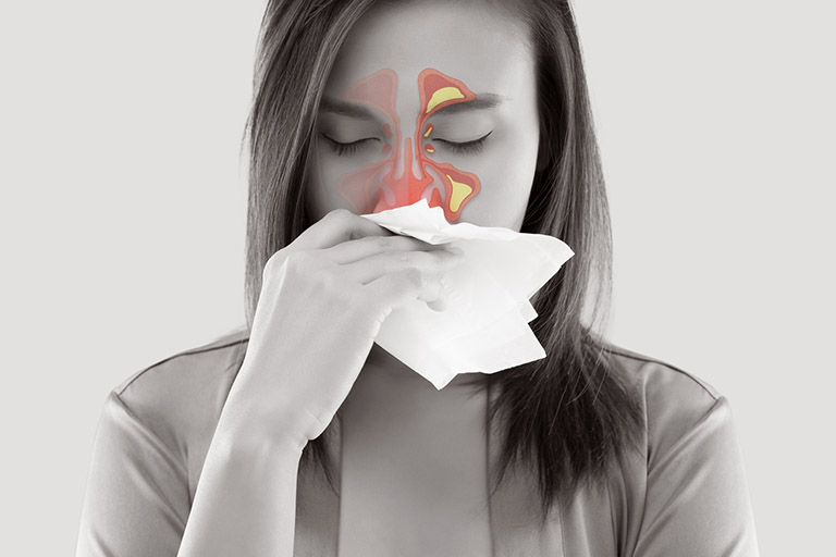 Polyp mũi có nguy hiểm không?