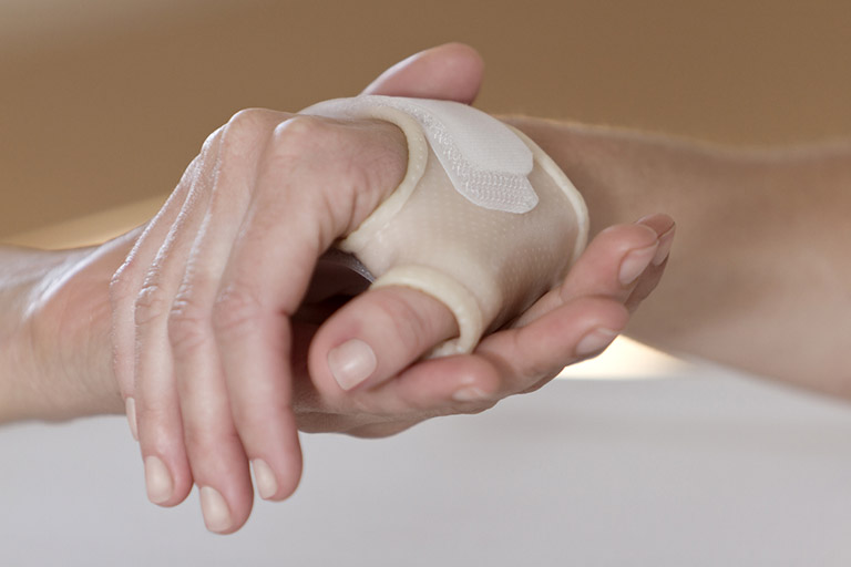 Các bài tập điều trị hội chứng ống cổ tay