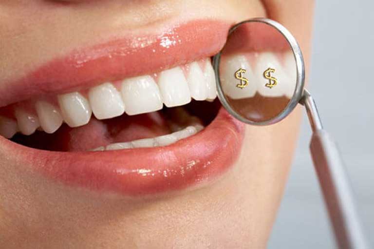 Bọc răng sứ thẩm mỹ là gì? Có tốt không? Giá bao nhiêu?