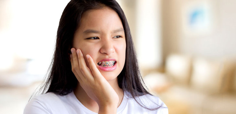 Niềng răng có đau không?