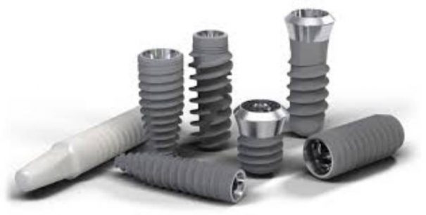 Trồng Răng Implant Loại Nào Tốt Và Phổ Biến Nhất
