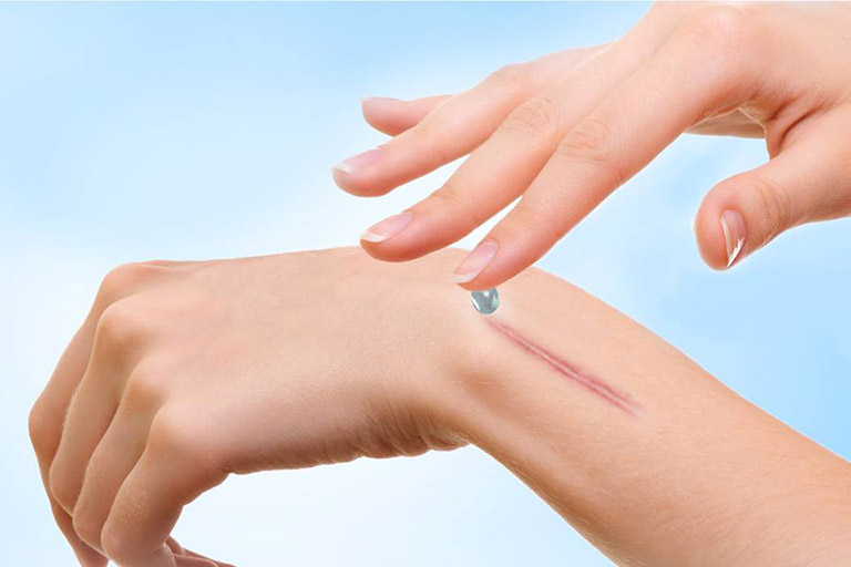 Kem Dermatix Ultra trị sẹo thâm có tốt không?