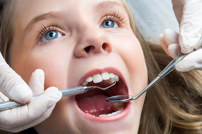 Thời điểm nào niềng răng cho trẻ là tốt nhất?