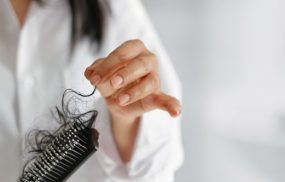 Rụng tóc nhiều là dấu hiệu của bệnh gì? Làm sao ngăn ngừa?