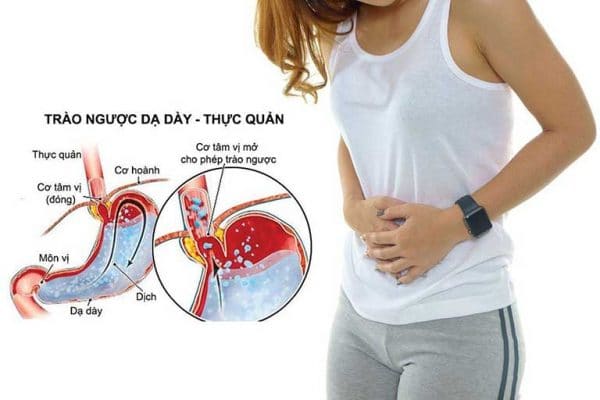 Viêm Loét Thực Quản Nguyên Nhân Triệu Chứng Và điều Trị