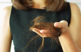 Nguyên nhân dẫn đến chân tóc yếu gây rụng tóc