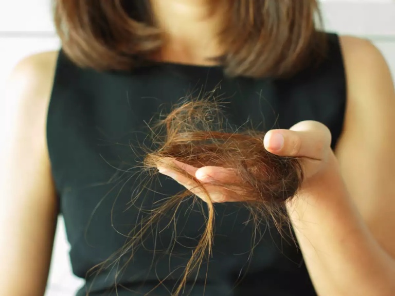 Nguyên nhân dẫn đến chân tóc yếu gây rụng tóc