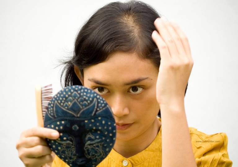 Rụng tóc ở phụ nữ thời kỳ mãn kinh
