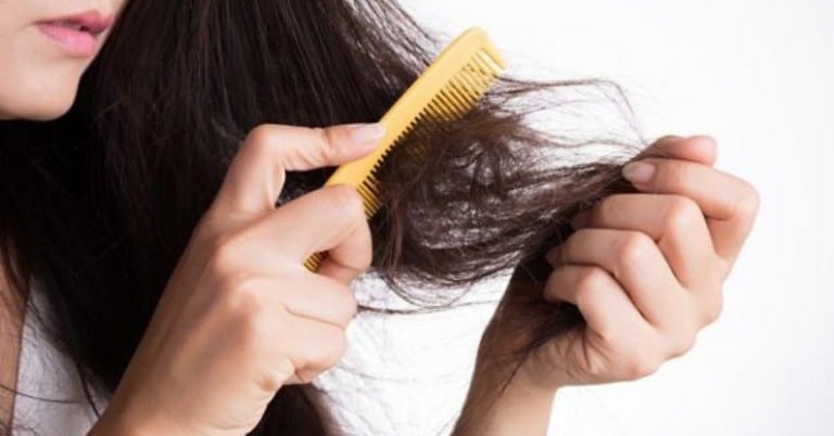 Rụng tóc sau sốt xuất huyết là do lưu lượng máu trong cơ thể suy giảm, không đủ để cung cấp dưỡng chất nuôi dưỡng các nang tóc