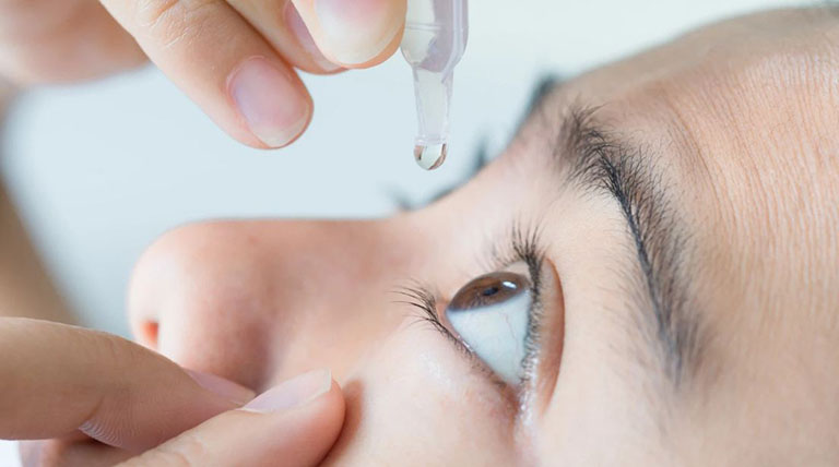 Thuốc kháng histamin dạng nhỏ mắt có tác dụng làm giảm triệu chứng ngứa mắt, đỏ mắt