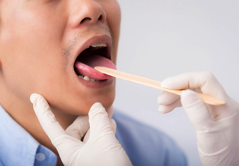 Địa chỉ khám bệnh về lưỡi tốt nhất TPHCM
