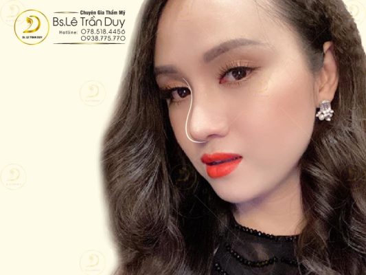 Có nên nâng mũi và cắt mí cùng lúc