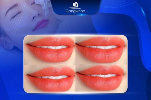 địa chỉ phun môi collagen tại TPHCM