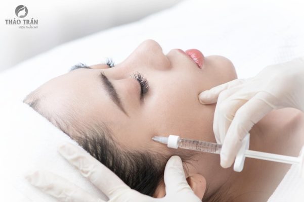 tiêm Filler tại Viện thẩm mỹ Thảo Trần