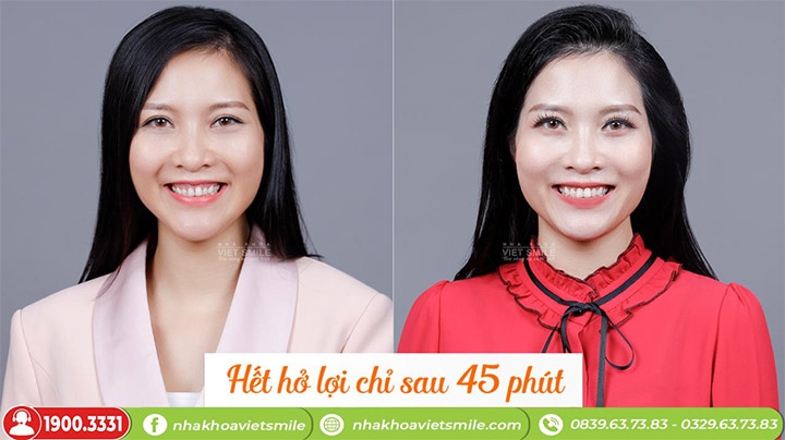 Nha khoa Việt Smile Hà Nội 