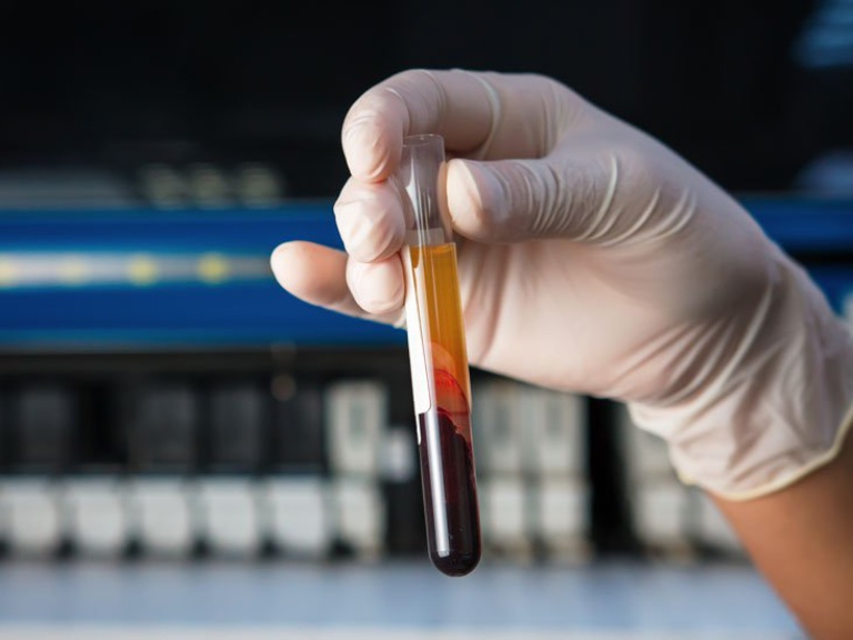 Xét nghiệm đông máu được thực hiện để tìm ra các bất thường về máu