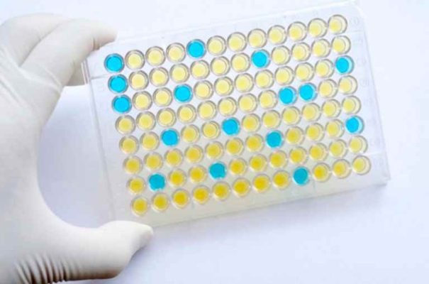 địa chỉ xét nghiệm giun đũa chó ở tphcm